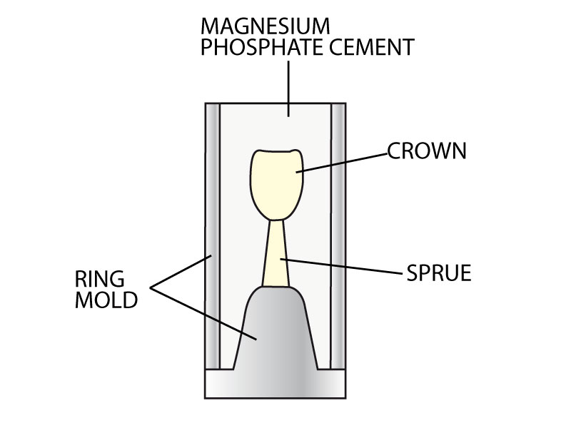 dental casting alloys